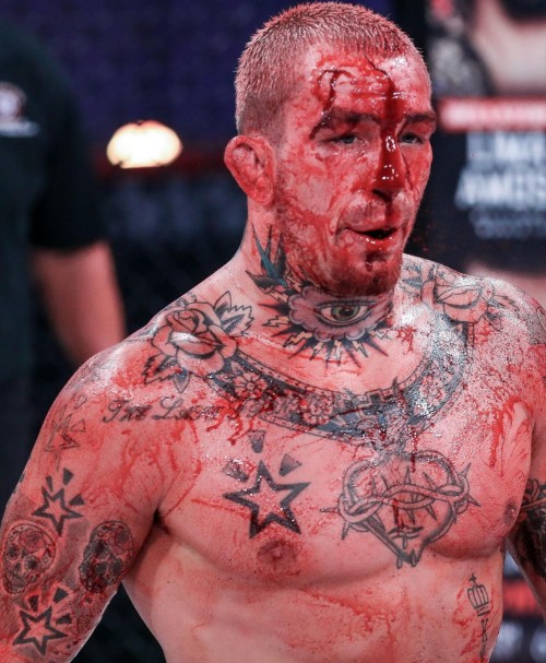 Bloody Fighter Austin Vanderford