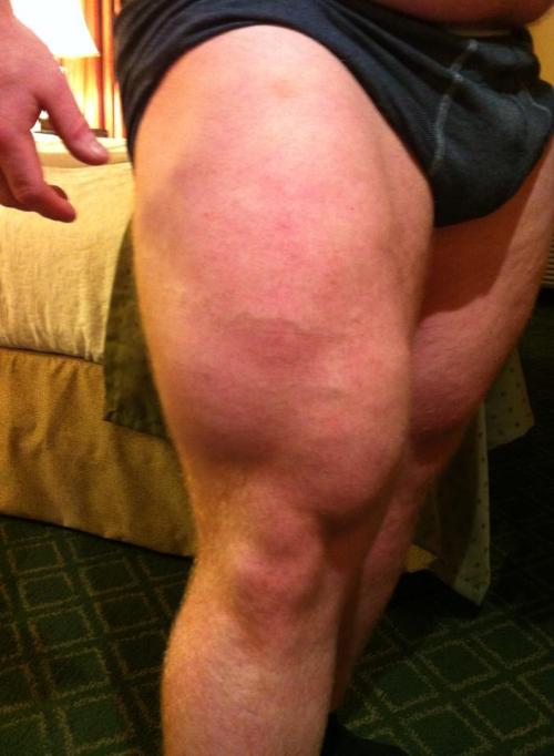 thebigbearcave:  Yes, his thighs are indeed ridiculous….. so is so much else on him