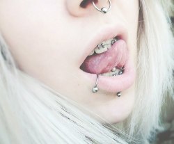 I have such a thing for braces on girls.