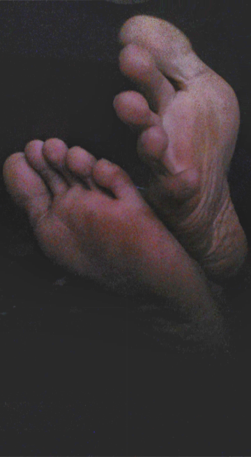 g-feet20:  An old set of photos I took with a webcam a while back. Sorry about the