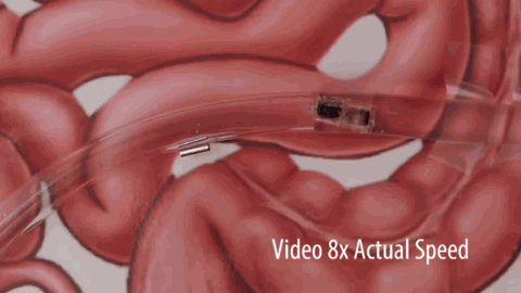 Txchnologist — Smart Pill Capsule Could Represent Future of Drug...