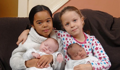 These are the Durrant twins from the UK! PS – Chances of having “two-toned” twins 