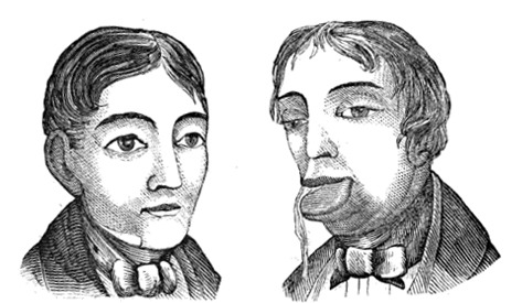 gucciballs:  deathandmysticism:  Martin Larmont, The Effects of Masturbation, Medical