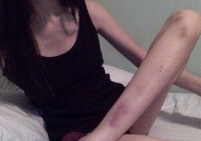 blackcoffeesadness:  bruised knees, bruised soul