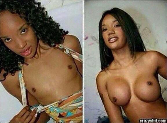 randomlilworld:  When you buy breast implants from Groupon