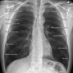 radiopaedia:  Medical Imaging Anatomy Course