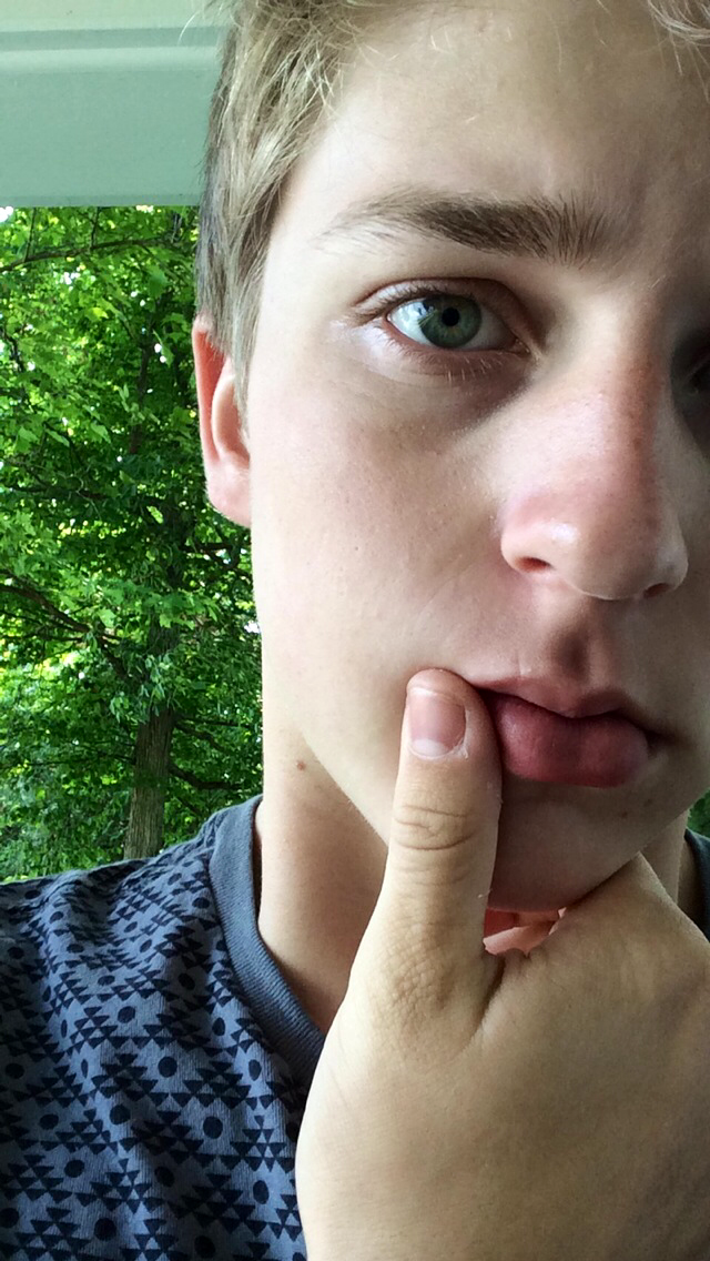 hilloween:  I have an edgy scar on my lip 