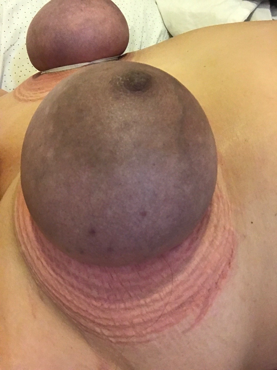 bigtiedtits: In an attempt to cause more pain and coloration than ever before, I