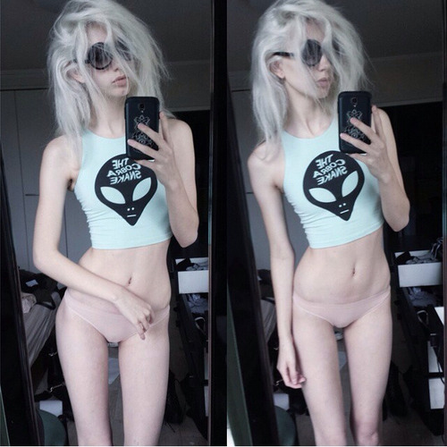 intoxicated-with-the-madness:  My all time favorite thinspo pic