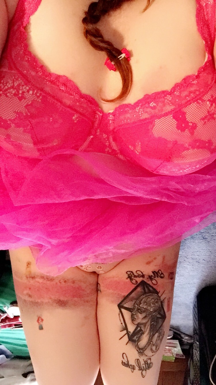 braidsandbruisedknees:  I’m the cutest when I’m covered in bruises