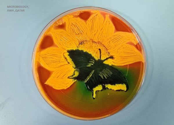 huffingtonpost:  A Microbiologist Recreated ‘Starry Night’ With Bacteria In A