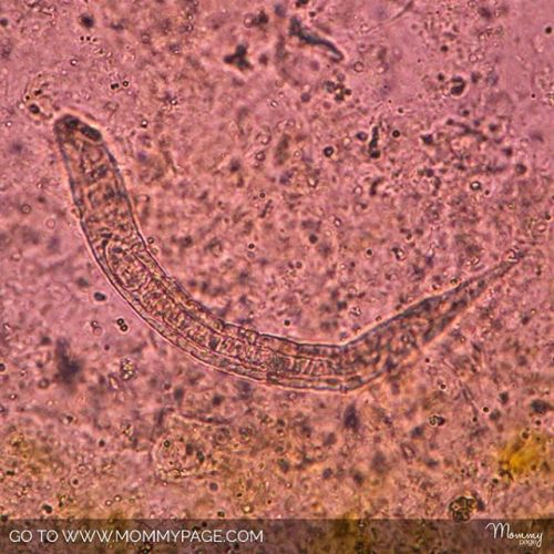 Here’s How A Disgusting Parasitic #WORM Can Actually Help You Get #PREGNANT &mdash;&mdash;&mdash;&md