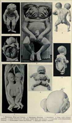 Examples of the some of the various deformations of the fetus