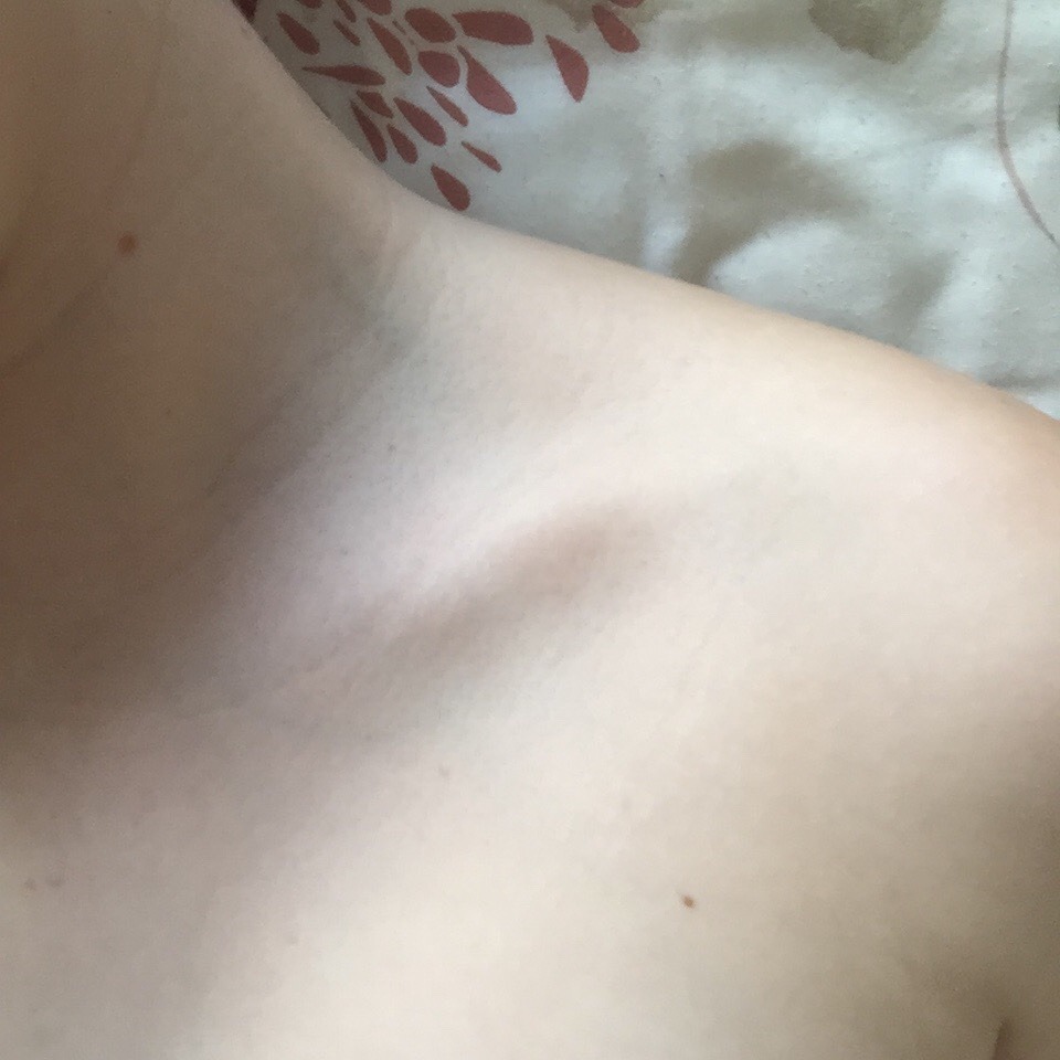 surmesgenoux:Details
