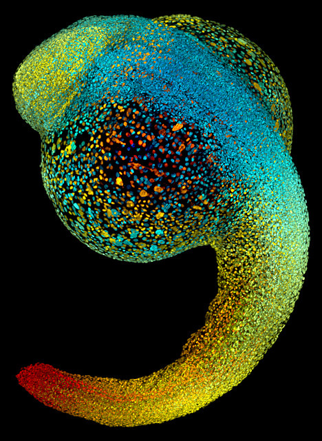 Zebrafish embryo | ZEISS MicroscopyJust 22 hours after fertilization, this zebrafish embryo is alrea