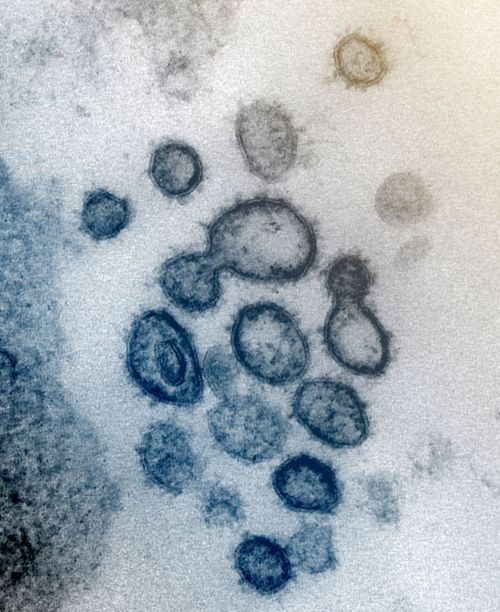 New Images of Novel Coronavirus SARS-CoV-2 Now AvailableHigh-res / Flickr downloadCredit:  NIAI