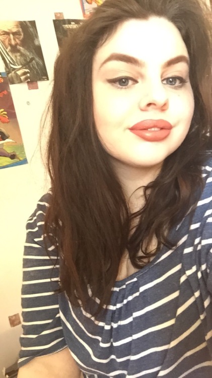 My lips look like they&rsquo;ve been taken of a brats doll so the injections went well