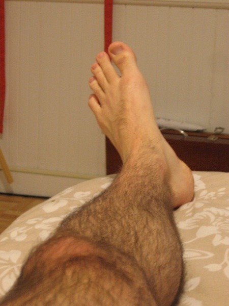Hairy legs and hairy boys