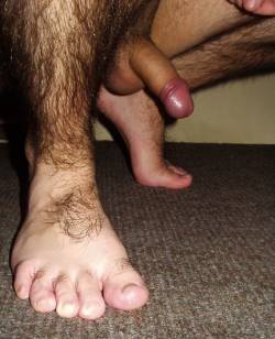 hairymalefeet