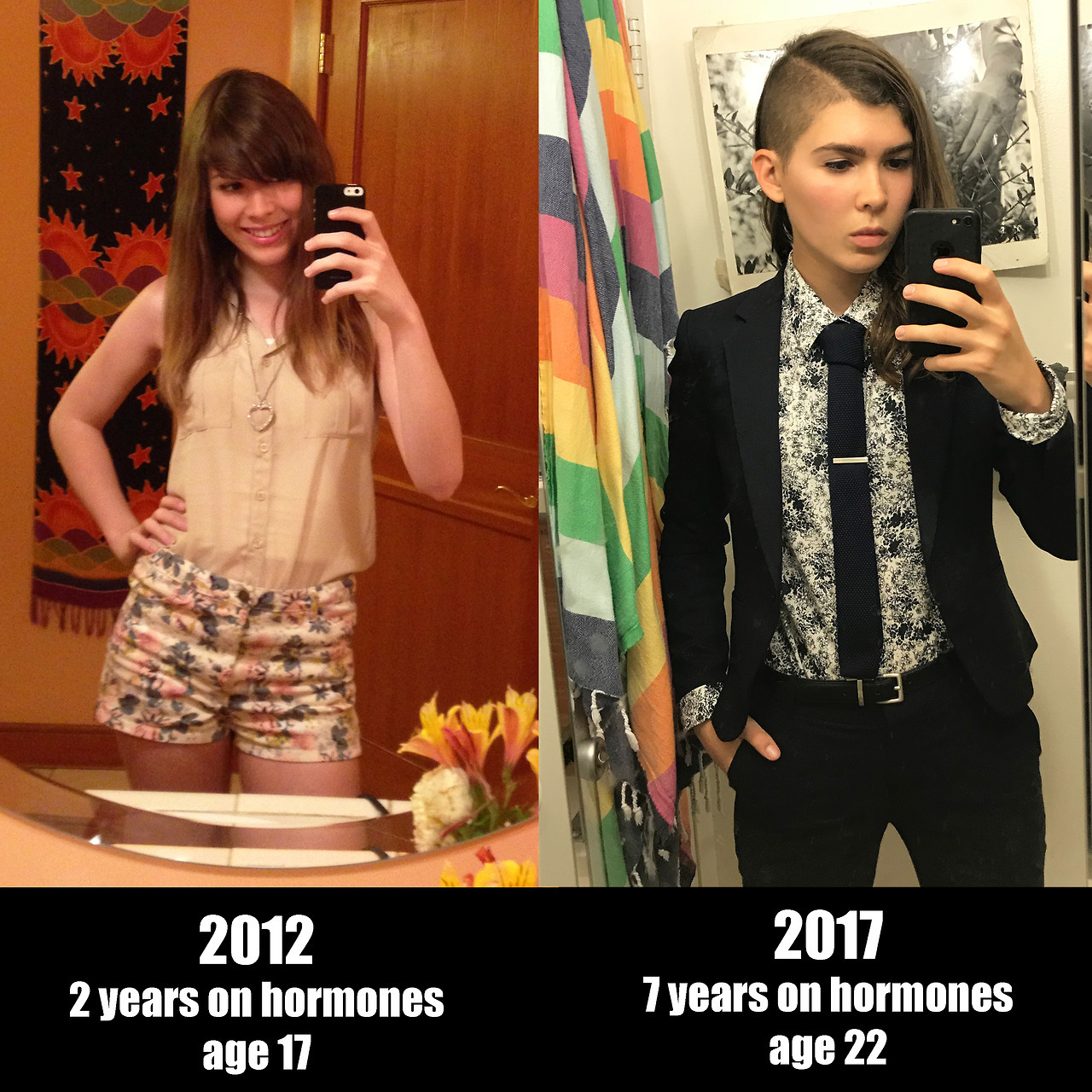 elierlick:Transitioning isn’t always linear. It isn’t always “from one gender