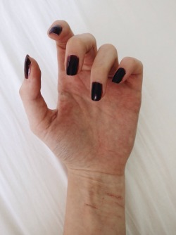 poppyflowrs:  my scars remind me that my past is real