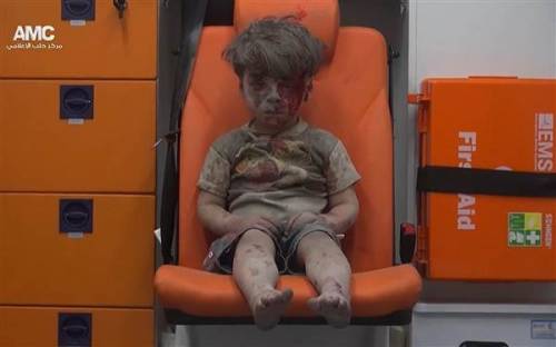 Haunting photo of wounded boy captures horror in SyriaVideo footage shows 5-year-old Omran Daqneesh 