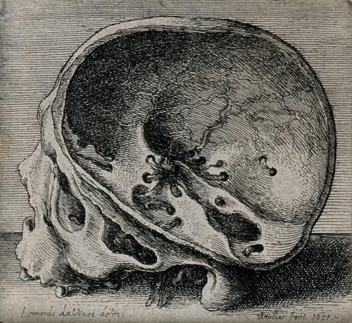 cross-section of skull in profile view, showing the intercranial nerves and vessels. | wenceslaus ho