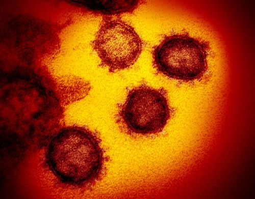 New Images of Novel Coronavirus SARS-CoV-2 Now AvailableHigh-res / Flickr downloadCredit:  NIAI