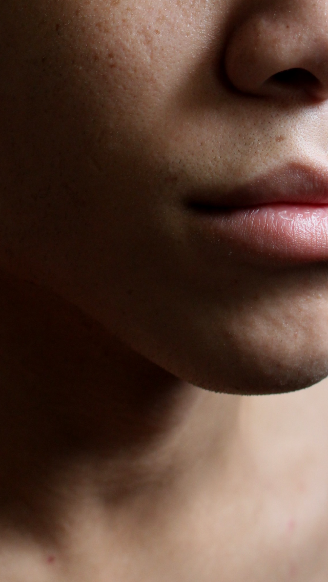 nembhard:MY SKIN.