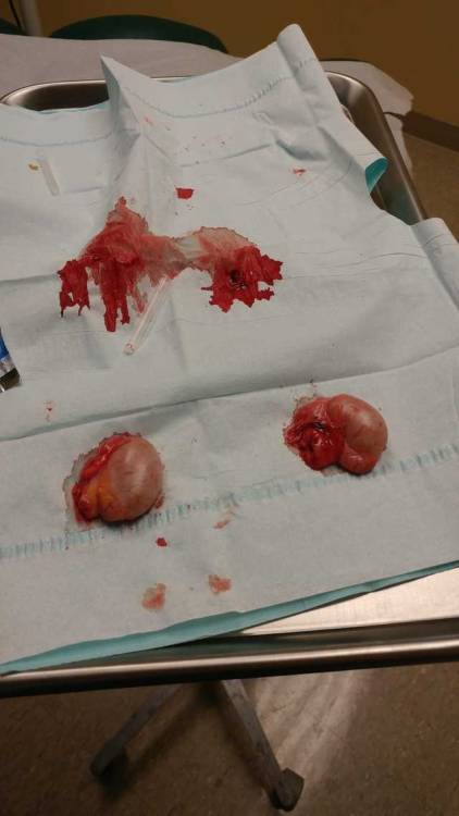 Testicles from orchiectomy #eunuch castrated orchiectomy testicles
