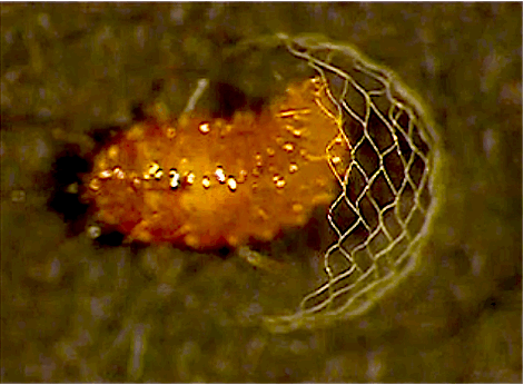 rotifers:  scientificvisuals:  Spongillafly larvae (genus Climacia) weaving distinctive chain-link cocoons. They spin another cocoon inside the fence. Sources here and here. More images here.   I’ve seen adult spongillaflies but have yet to encounter