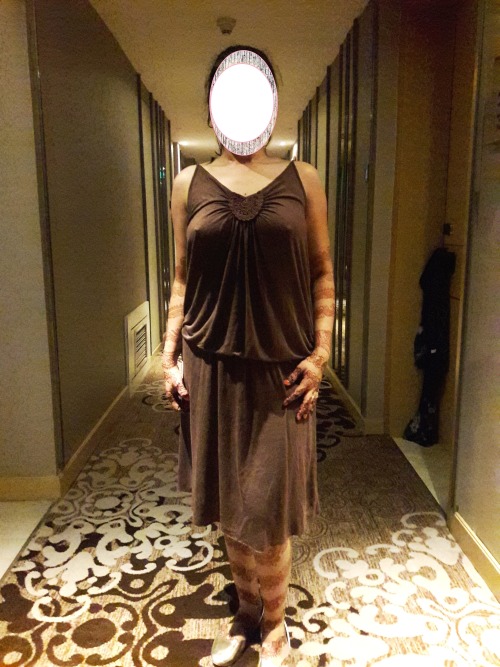 pankhurikunallkoblog:  Exposing in hotel’s adult photos