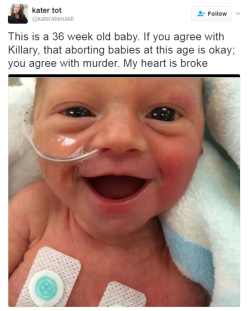 destinyrush: some people…smh  36 weeks is technically full term, who&rsquo;s aborting babies at full term? All three of my kids were born at either 36 or 37 weeks and none of them needed anything, they came home that next day. Quit with the bullshit,