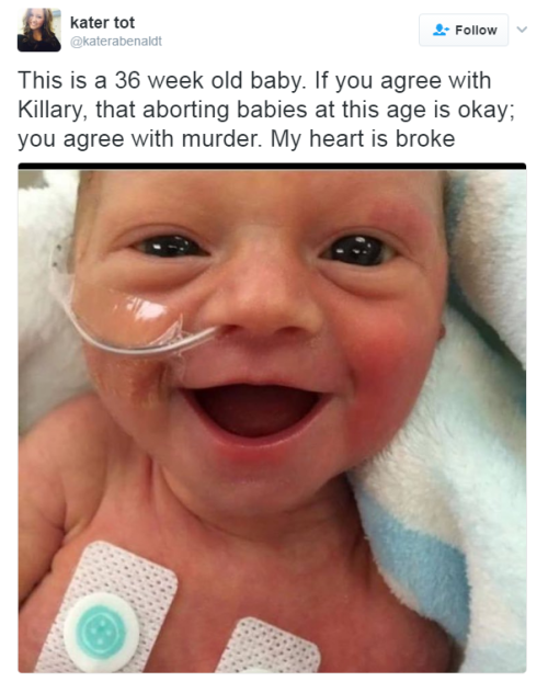 destinyrush: some people…smh  36 weeks is technically full term, who’s aborting babies at full term? All three of my kids were born at either 36 or 37 weeks and none of them needed anything, they came home that next day. Quit with the bullshit,