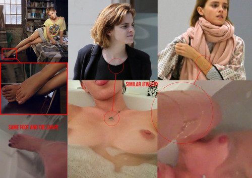 onlynudecelebsallowed:  Emma Watson