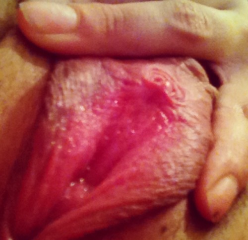 fallfartherdowntherabbithole:  frickfrackqueen:  Vagina pics with my large labia sup  <3 