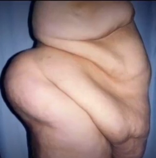 Porn photo Stunning bariatric topography