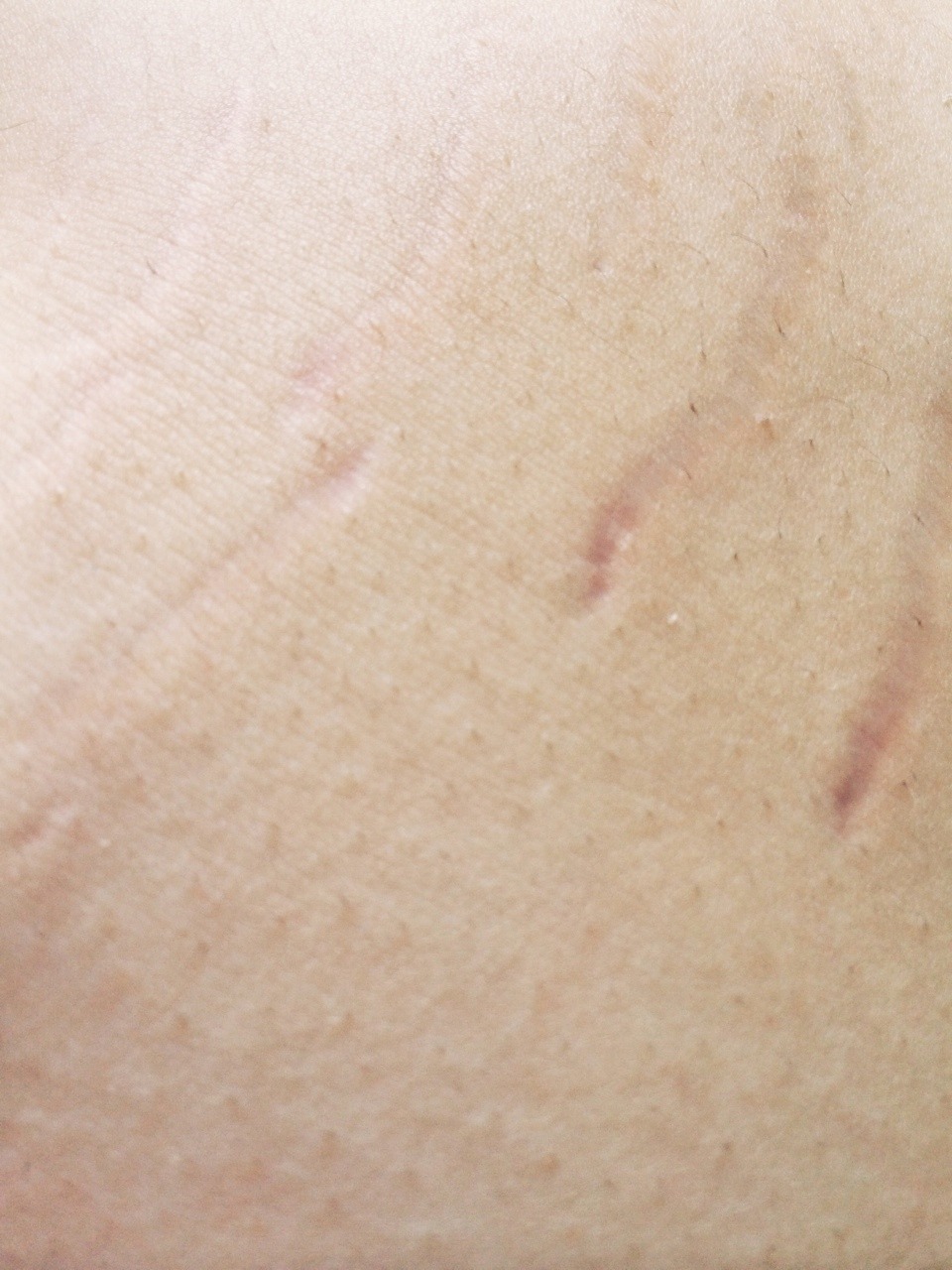 virginsplayground:  These are the parts of myself that I have been taught not to