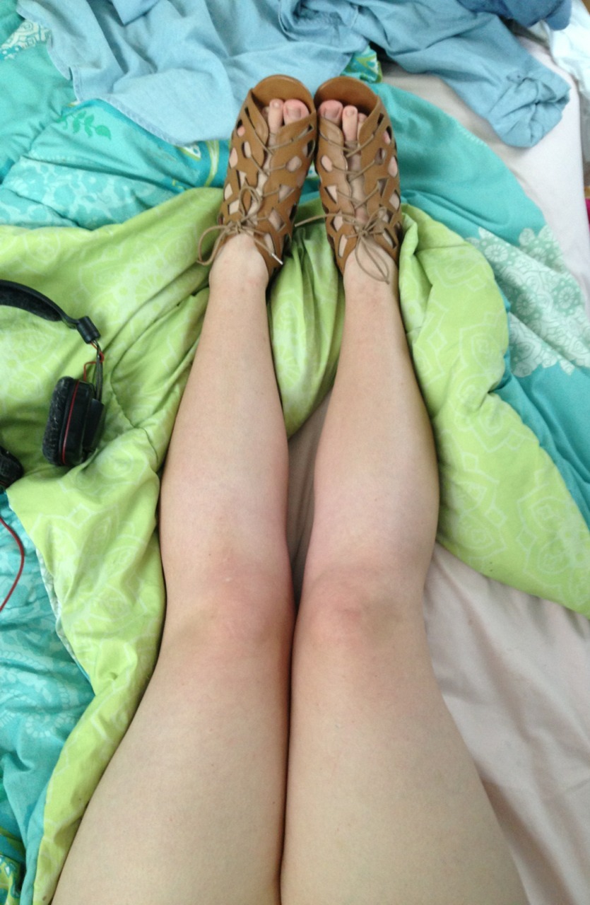 fatphrodite:  These shoes are sooo adorable! (And so uncomfortable.) also my big