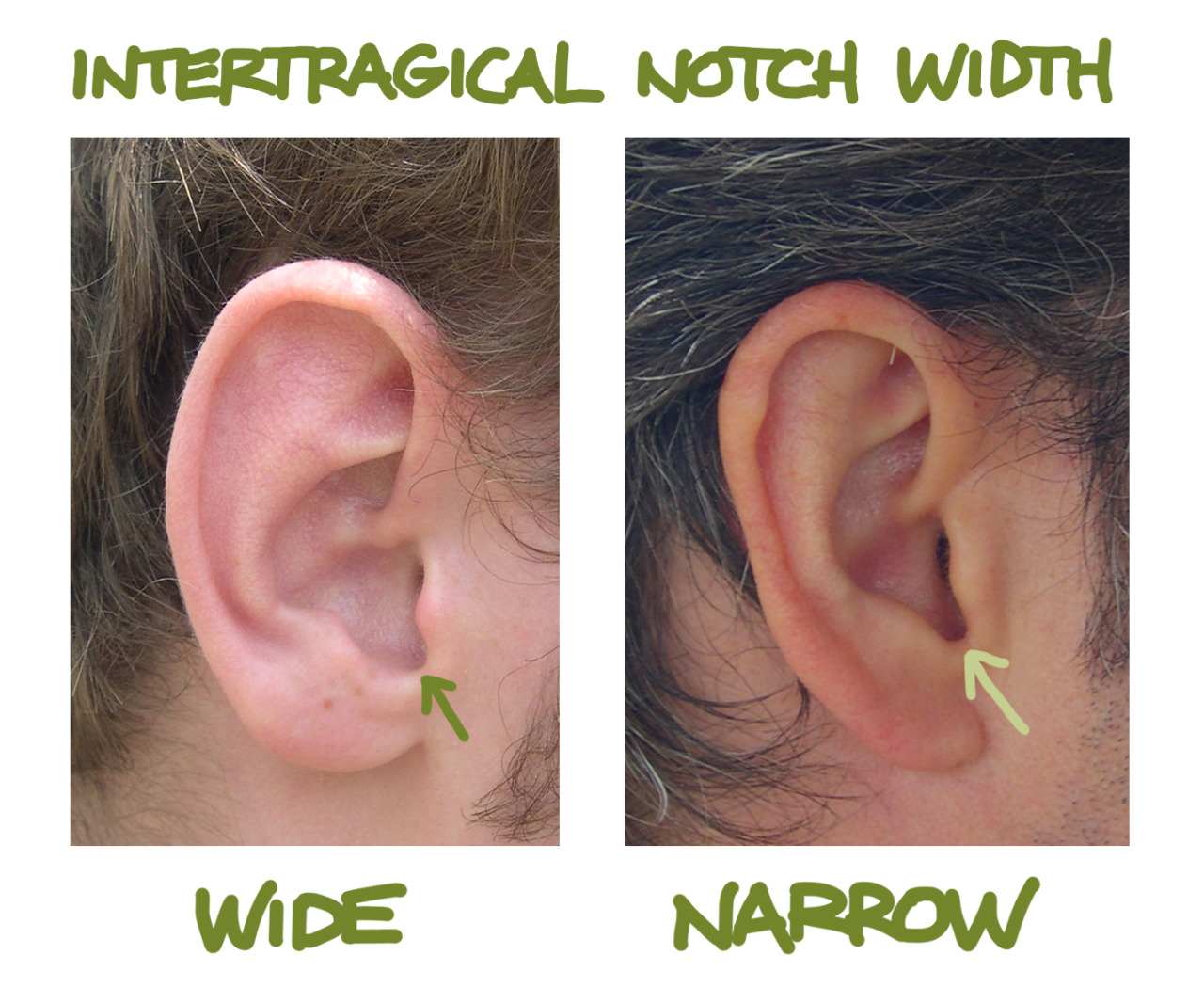 anatoref:  EarsTop ImageRow 2Row 3 &amp; 4 (Right)Row 4 (Left) 