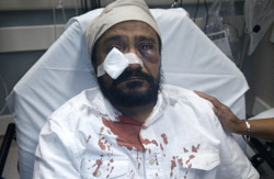 alwaysbewoke:  kaagazkalam:  This is Inderjit Singh Mukker, a Sikh man from Chicago who was brutally assaulted on September 8, 2015. On his way home from the grocery store, his car was tailgated by another. When Inderjit Singh pulled over, the driver