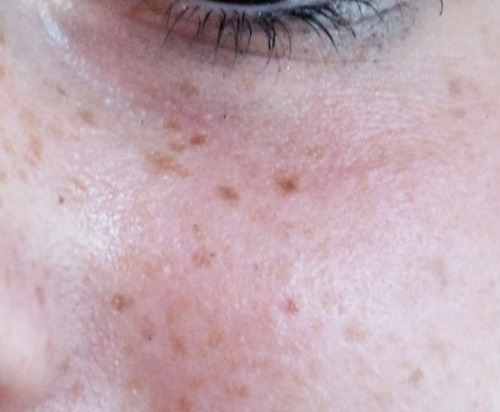 vangch:Friend’s freckles & The Andromeda Galaxy (source: NASA)I still tell myself that this post