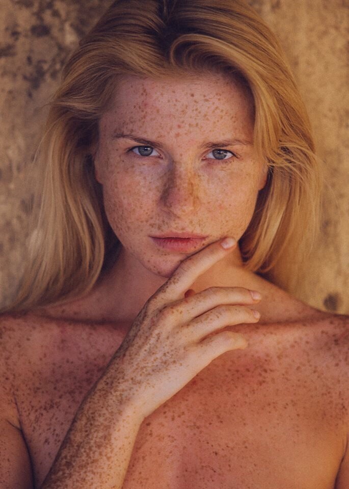 amazing freckles:Polina Kultbest of erotic photography:www.radical-lingerie.com