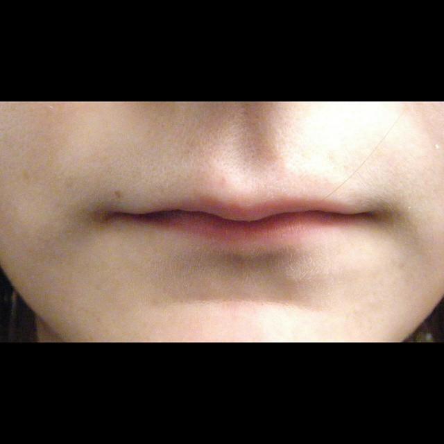If your lips like this&hellip;&hellip;&hellip;..Don&rsquo;t kiss
