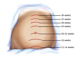 geekymedguru:  Estimation of gestational