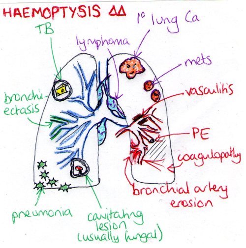 Some causes of haemoptysis. Divided into haematological (red), infectious (green) and malignant (pur