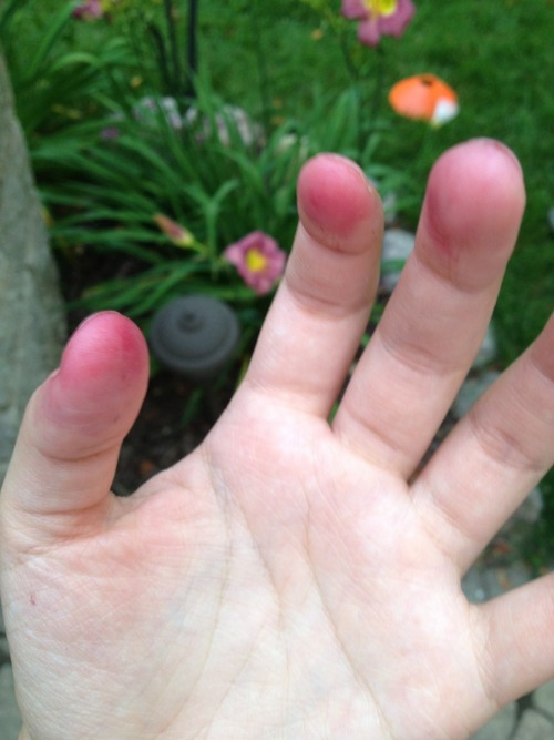 doelita:your—nymphetamine:Cherry-stained fingers