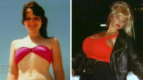 beforeandafterbimbos:  Dee Stein adult photos