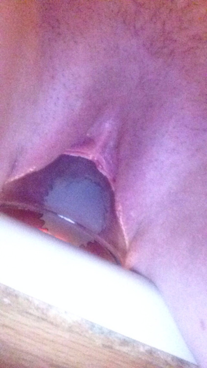 whatcanyoufit:  Another sexy submission from Pretty Girl.   Submit to stickitin001@gmail.com  Wow, for a teen that is serious gape ability! What a thoroughly stretched out hole! Heavenly.