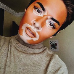 the-black-bolin:  zkou:  maaharaam:  lucasfromtheblock:  hellyeahchantellewinnie:    I really wish people would stop doing this shit like This is not “art” you're literally doing black face  This is a real condition called “Vitiligo”…The